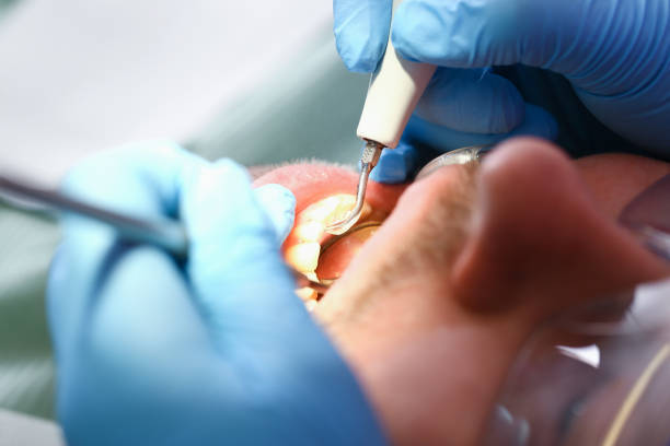 Best Emergency Treatment for Oral Infections in Saratoga Springs, UT