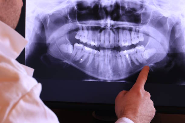 Best Emergency Denture Repair in Saratoga Springs, UT